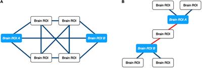 Changes in the geometry and robustness of diffusion tensor imaging networks: Secondary analysis from a randomized controlled trial of young autistic children receiving an umbilical cord blood infusion